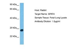 SPATA4 Antibody, Novus Biologicals 100 &mu;L; Unconjugated:Antibodies,